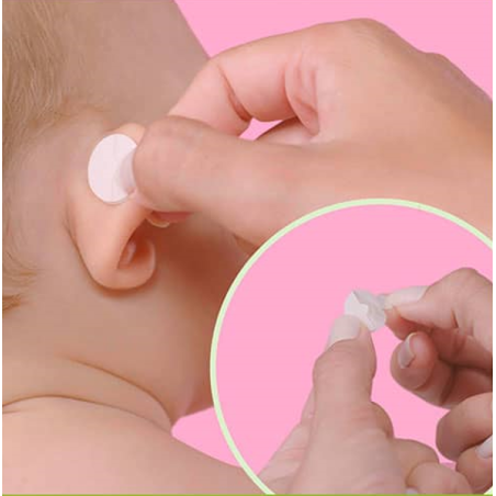 Otostick Bebé OFERTA 2x1 8 Correctores de Orejas