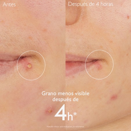 Caudalie Vinopure Stop Granos Salicílico 15 ml | Cosmética | Farmae...