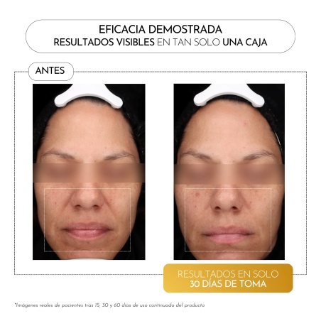 Luxmetique Fórmula HYAGOLD 15 viales | Nutricosmetica | Farmaelglobo